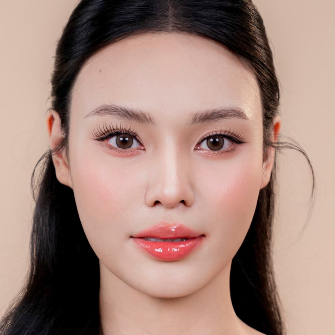 Patient Luu Phuong Anh - After One Fit rhinoplasty
