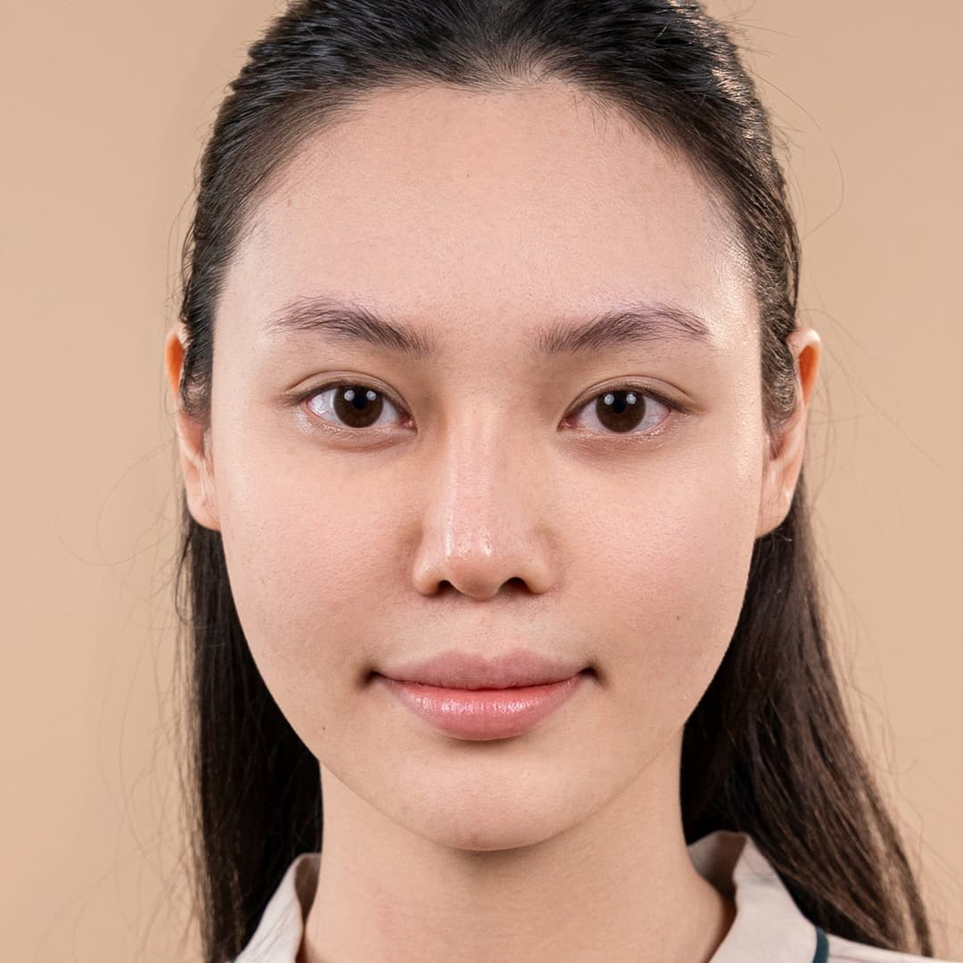 Patient Luu Phuong Anh - Before rhinoplasty One fit