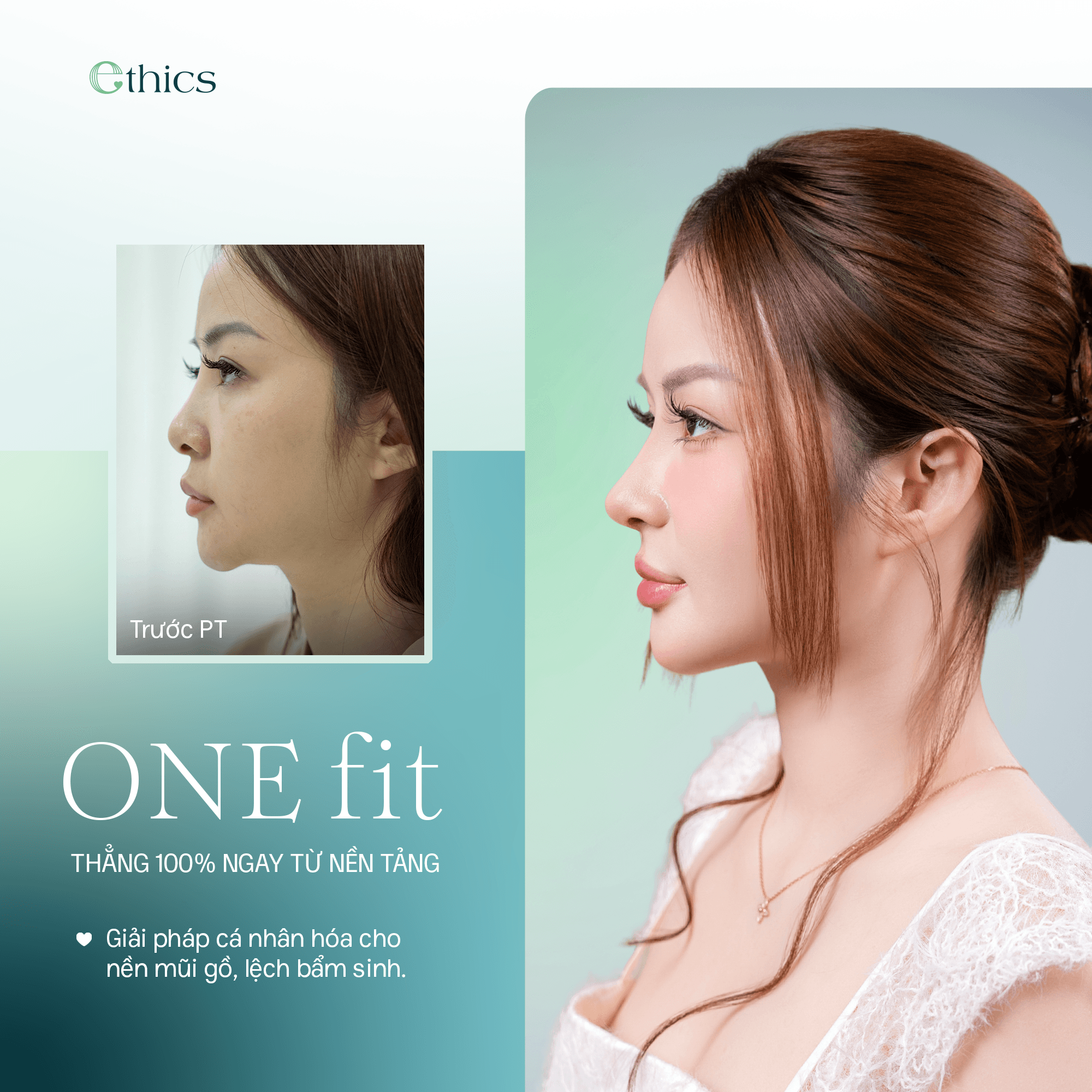 OneFit Premium Nose Enhancement