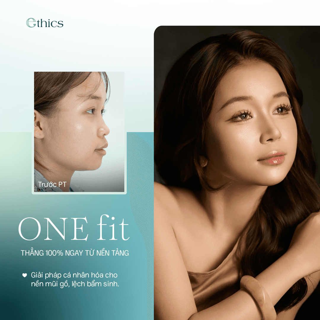 OneFit chin augmentation with Ethics' exclusive 3D-printed cartilage technology