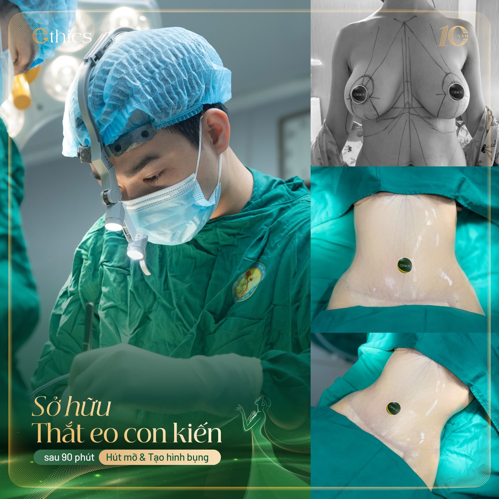 Overall figure – waist circumference of 80 cm or less