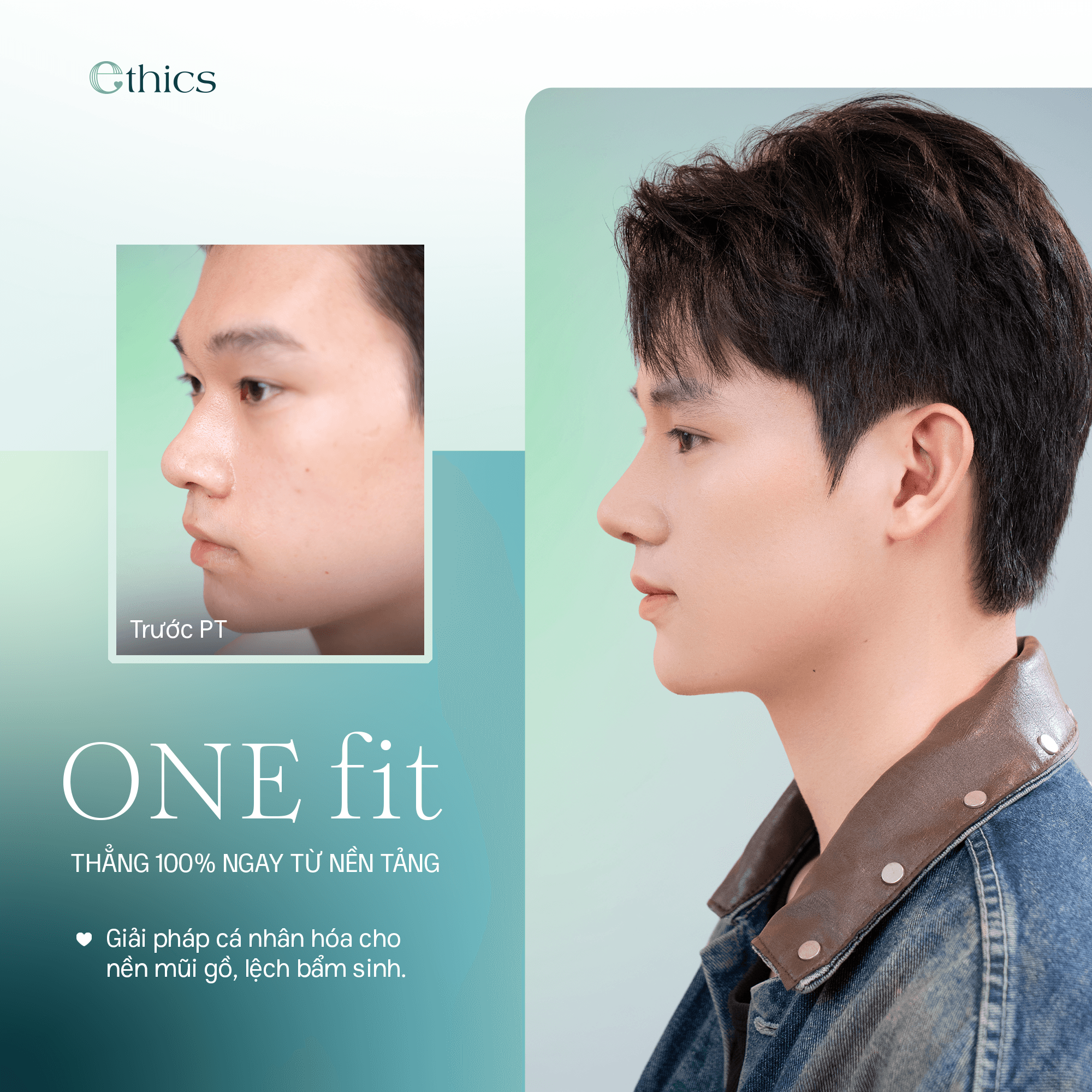 OneFit Nose Enhancement
